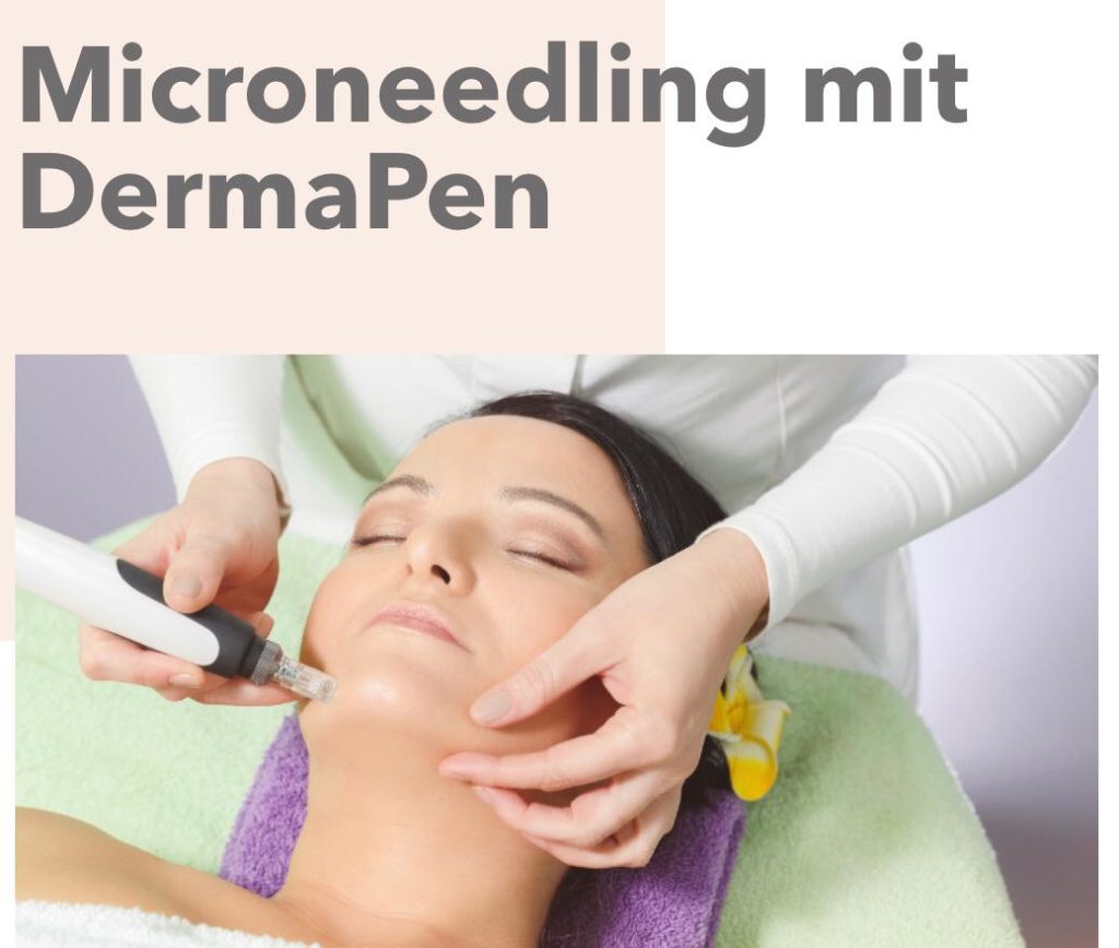 Microneedling